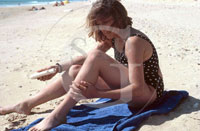 Sunburn
