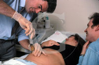 Amniocentesis